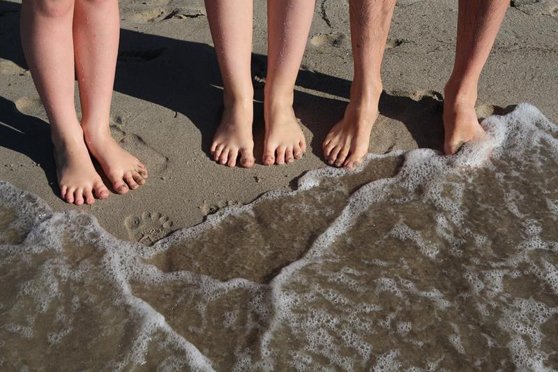 Hammertoes  Anaheim, CA, 