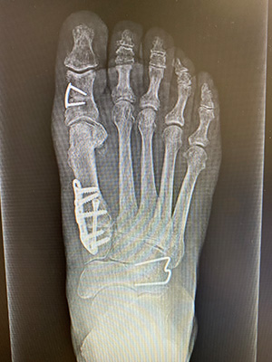 post-op-image01