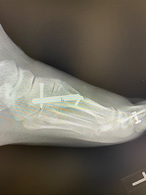 post-op-image02