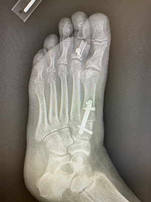 post-op-image03