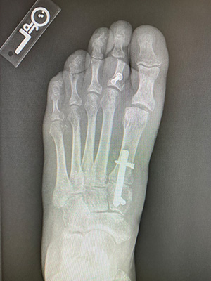 post-op-image04