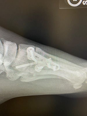 post-op-image05