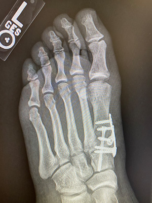 post-op-image06