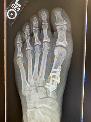 post-op-image07