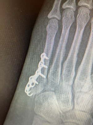post-op-image08