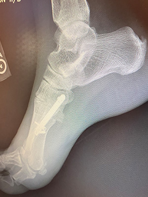 post-op-image10
