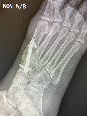 post-op-image11