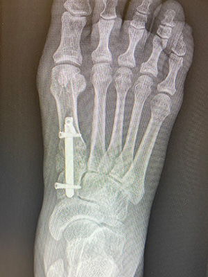 post-op-image12