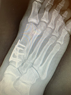 post-op-image14