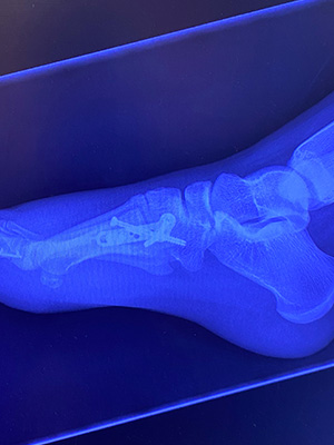 post-op-image15
