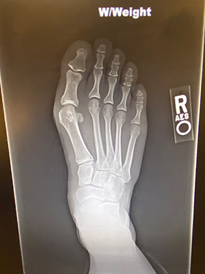 post-op-image16