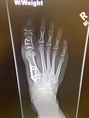 post-op-image17