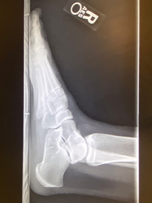 post-op-image18
