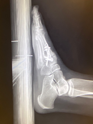 post-op-image19