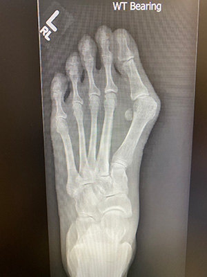 post-op-image20
