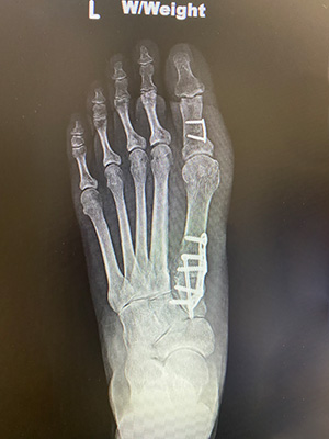 post-op-image21