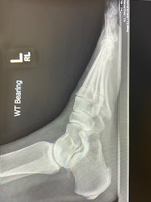 post-op-image22